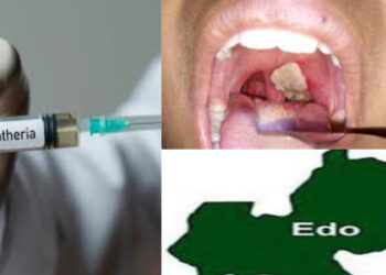Diphtheria in Edo State